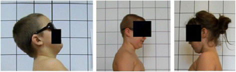 Fig. 16