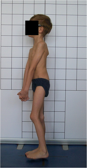 Fig. 21