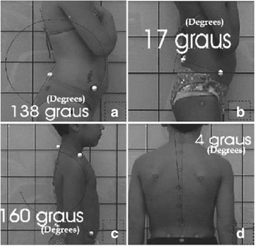 Fig. 29