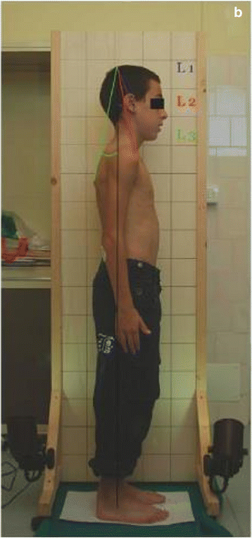 Fig. 27