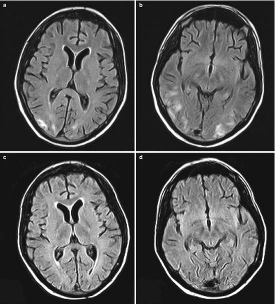 Fig. 30.3