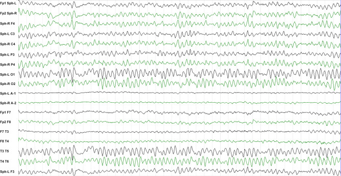 Figure 2