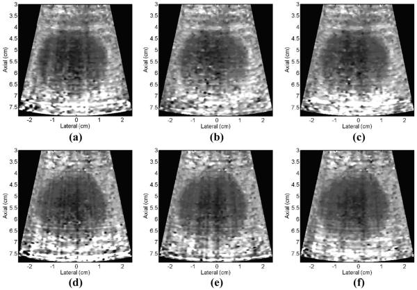 Fig. 15