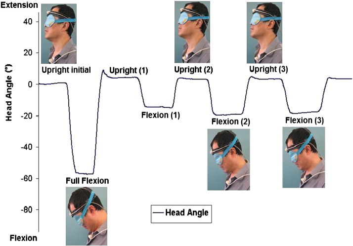 Fig. 2