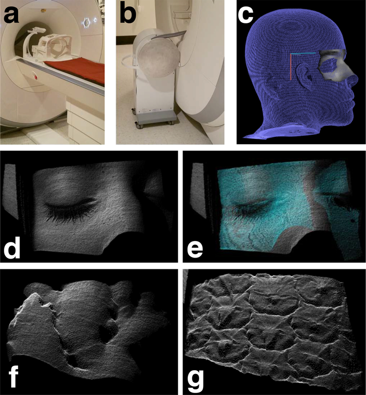 Figure 1: