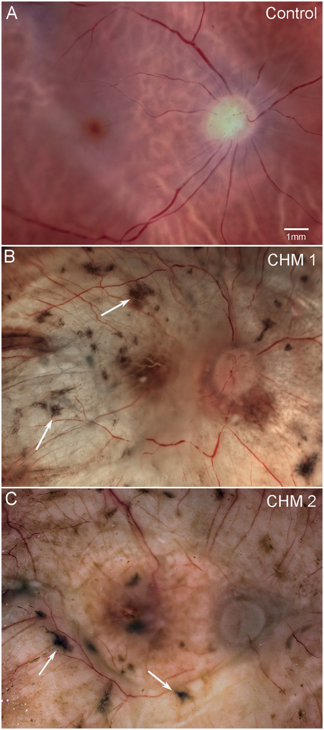 Figure 1