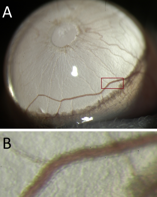 Fig. 10.