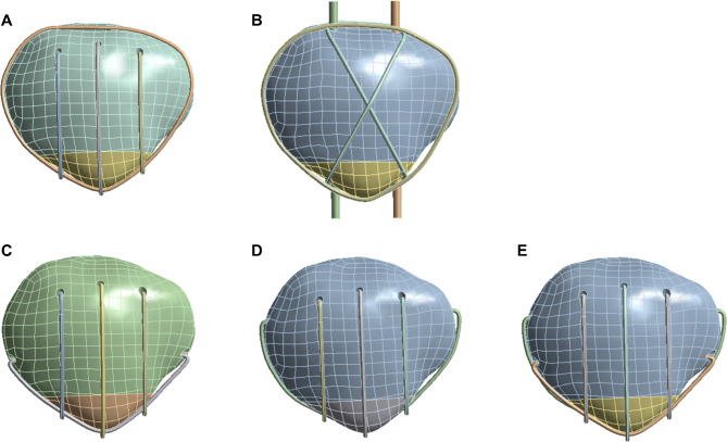 Fig. 2