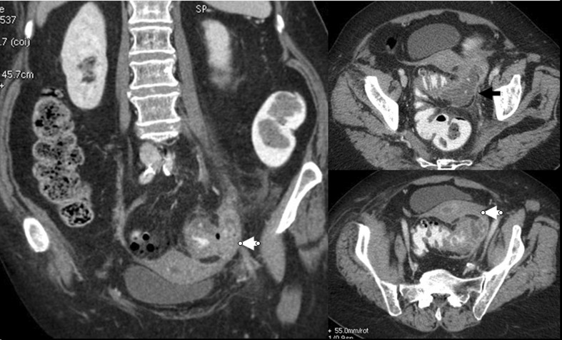 Fig. 19