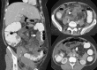 Fig. 16