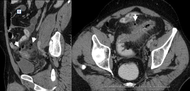 Fig. 15