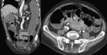 Fig. 17