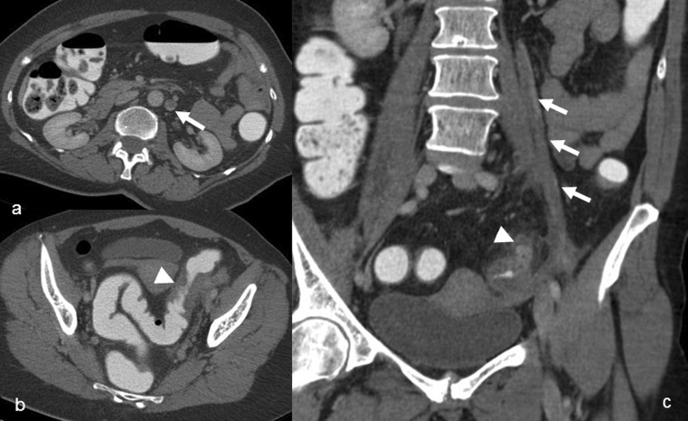 Fig. 4