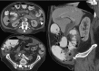 Fig. 12