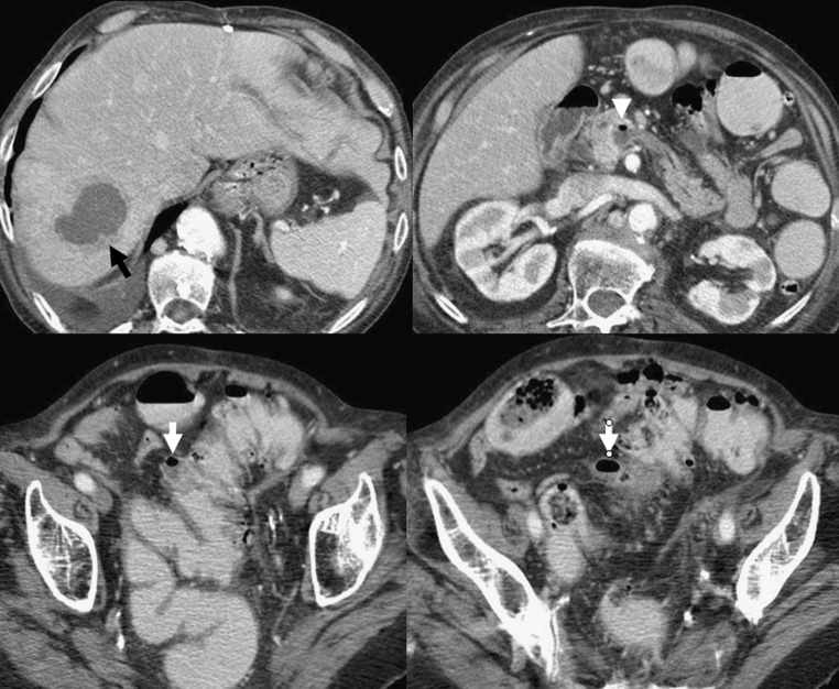 Fig. 21