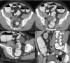 Fig. 22