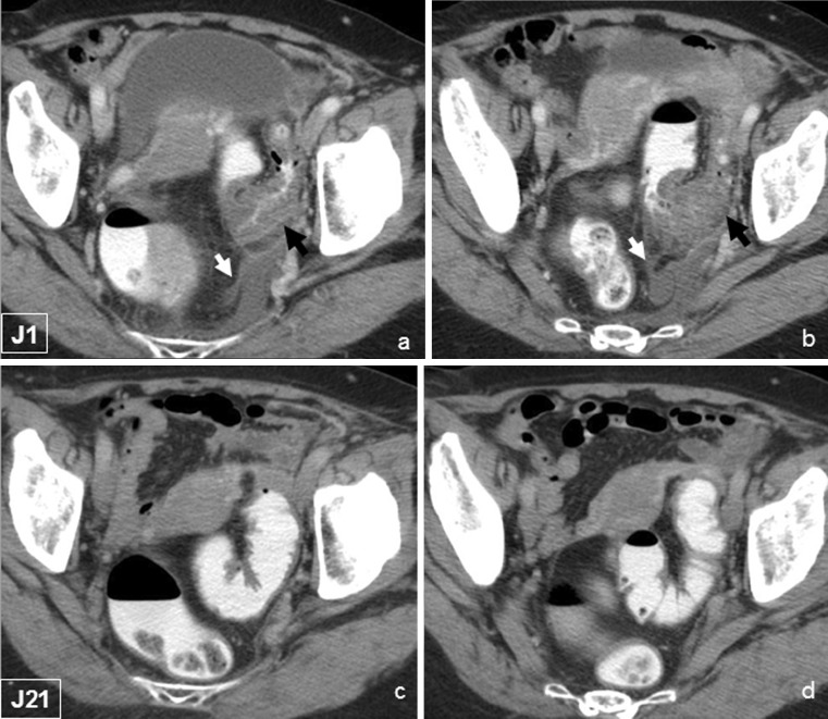 Fig. 1