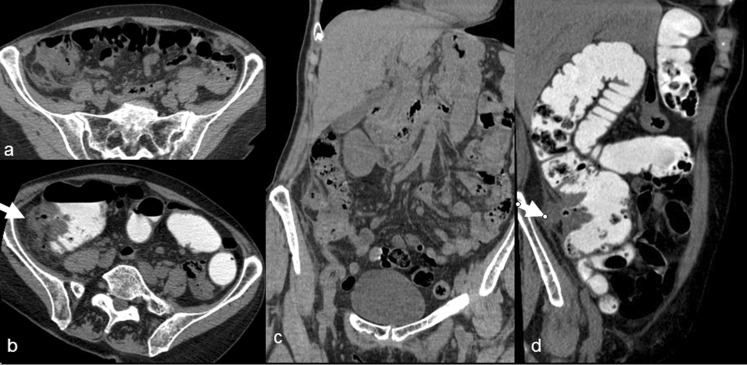 Fig. 3