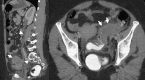 Fig. 26