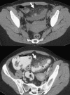 Fig. 24