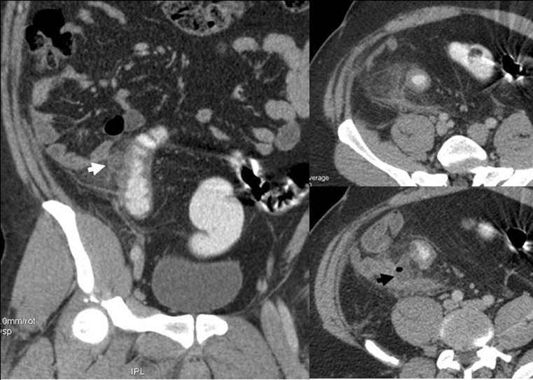 Fig. 11