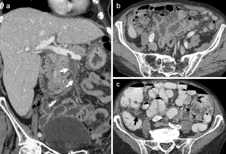 Fig. 20