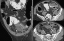 Fig. 14