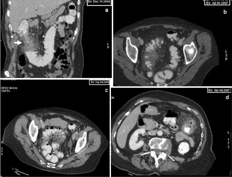 Fig. 13