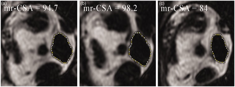 Fig. 2.