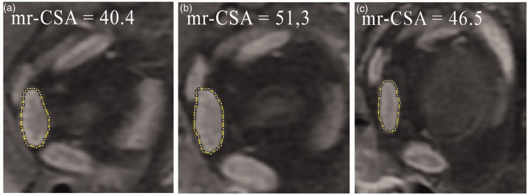 Fig. 3.