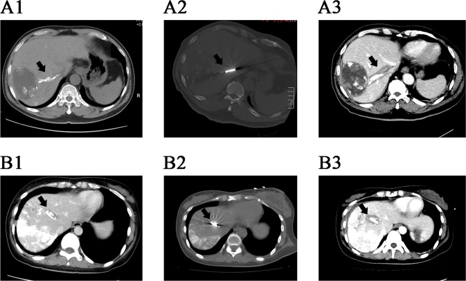 Fig 1