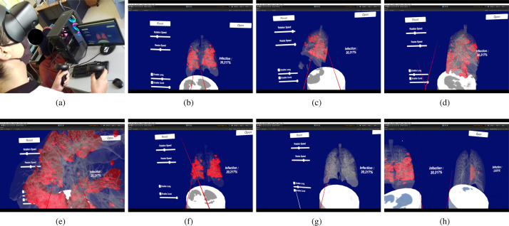 Fig. 15