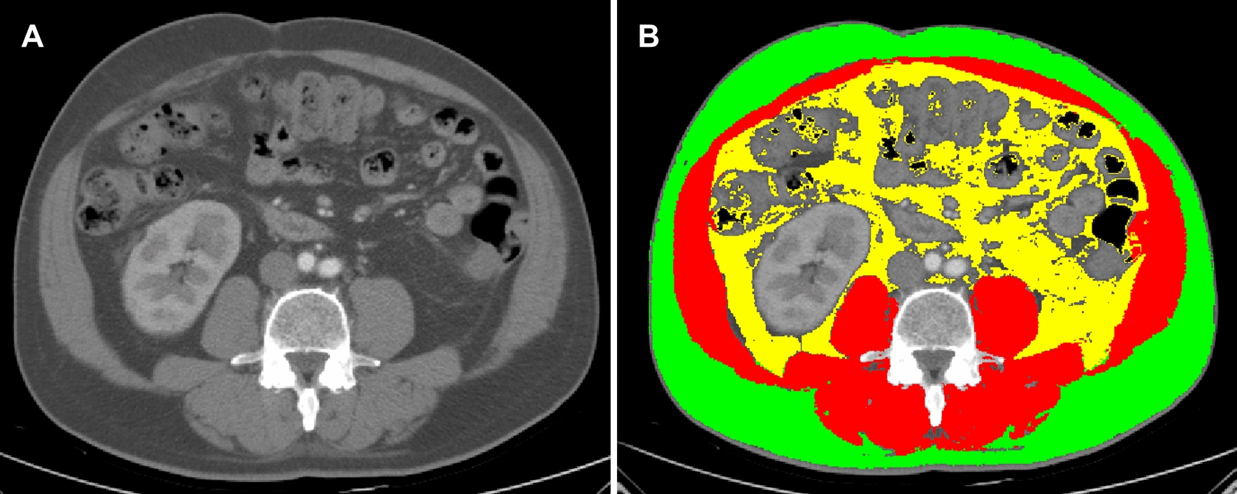 Fig. 2