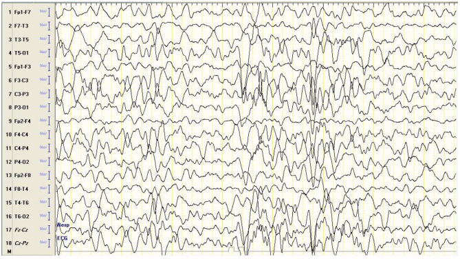 Fig. 1