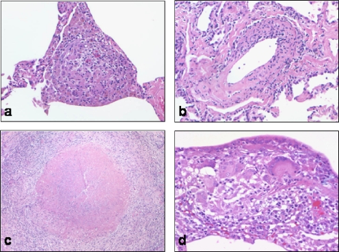 Fig 4