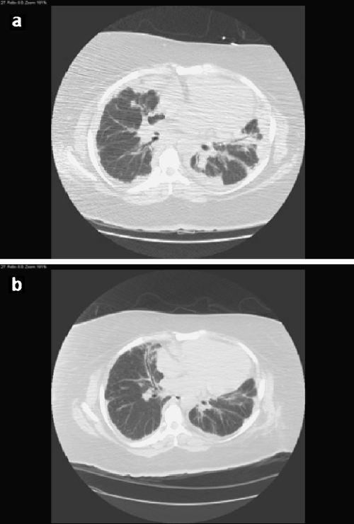 Fig 1