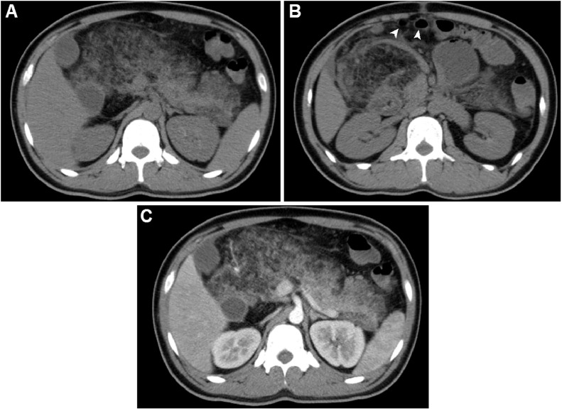 Fig 2