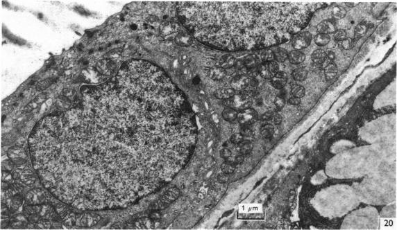 Fig. 20