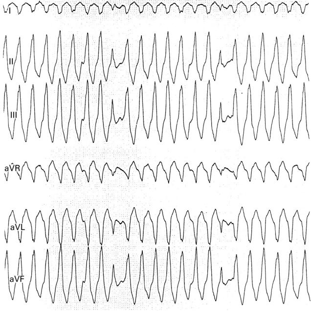 Figure 2  