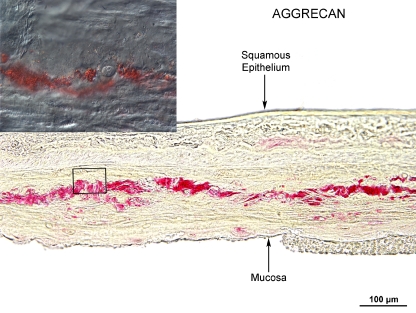 FIG. 3