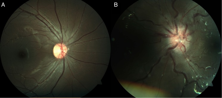 Fig. 2.