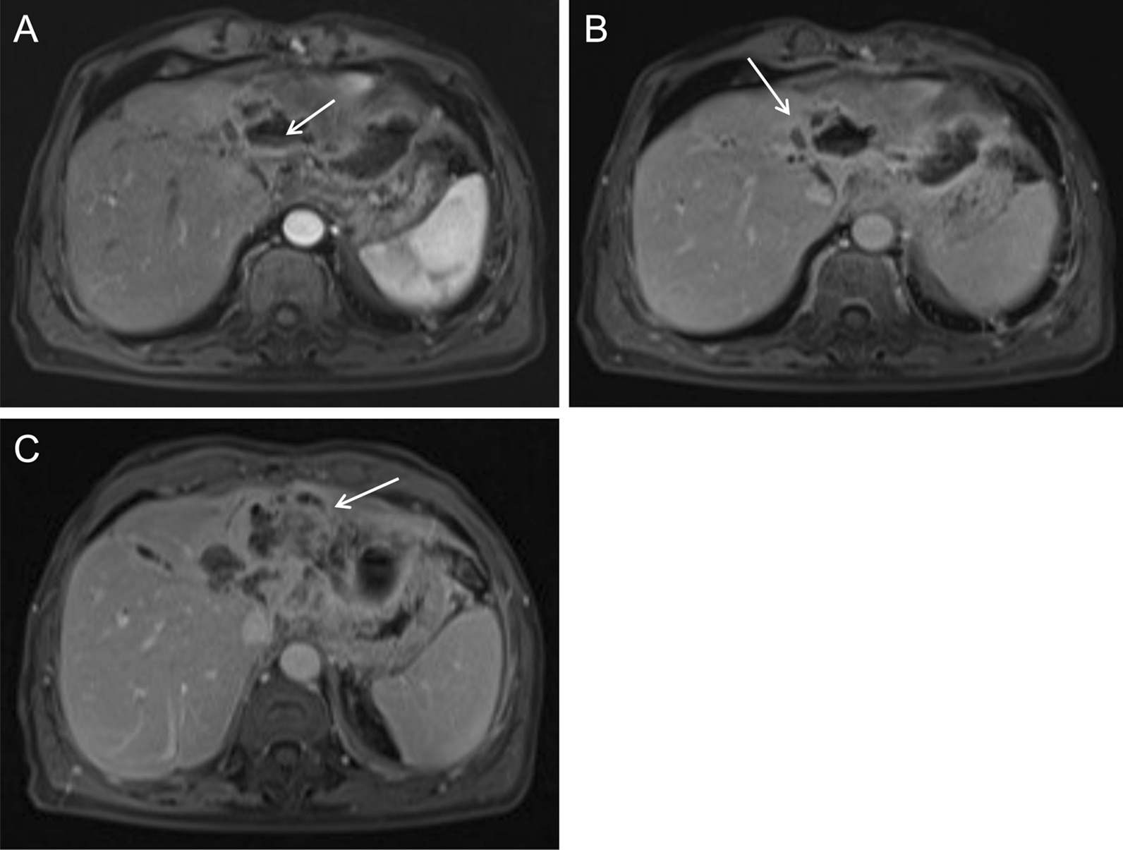 Fig. 11