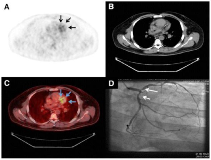 Fig 4