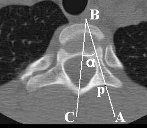 Fig. 1