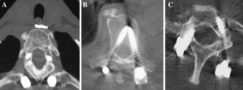 Fig. 2