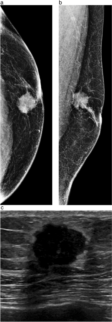 Figure 1a-c.