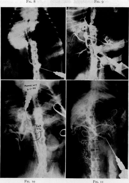 Fig. 8., Fig. 9., Fig. 10., Fig. 11.