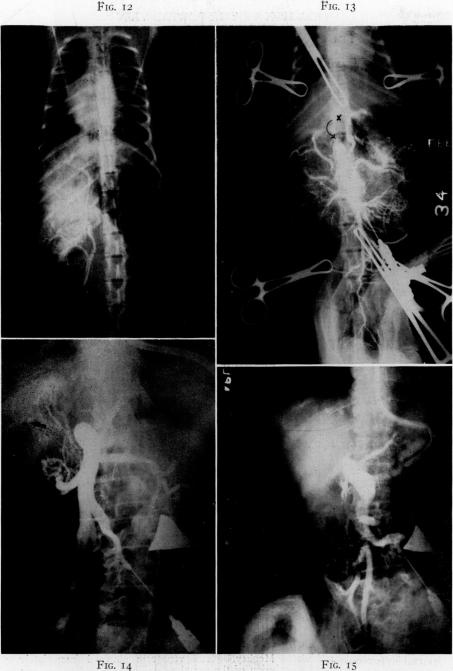 Fig. 12., Fig. 13., Fig. 14., Fig. 15.