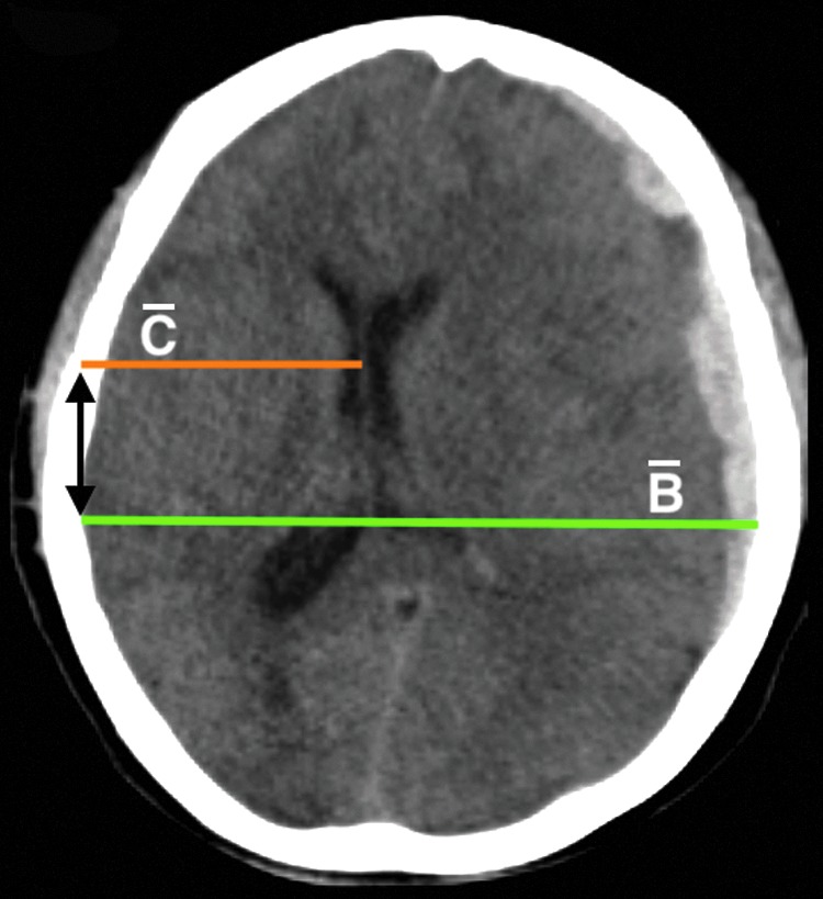 FIG. 2.