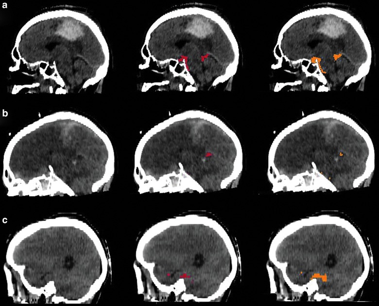 FIG. 5.